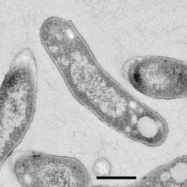 Koch y los bacilos: experimentos que contagian